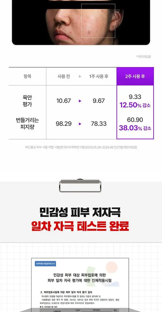 [단독기획/PDRN] 파티온 노스카나인 트러블 모공탄력 크림 45ml 기획(+15ml) 상세페이지 23